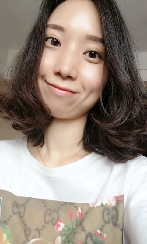 肉毒素瘦脸第7天吃脂燃ds吐素想了图片