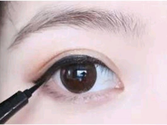 #文姐科普#哪些人不适合开眼角?1、两眼间距