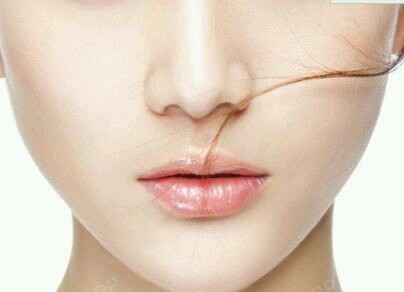 【福州美贝尔--激光祛痘】激光祛痘是通过特定