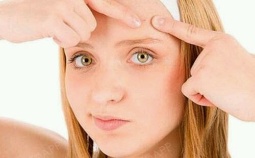 【福州美贝尔--激光祛痘】激光祛痘是通过特定