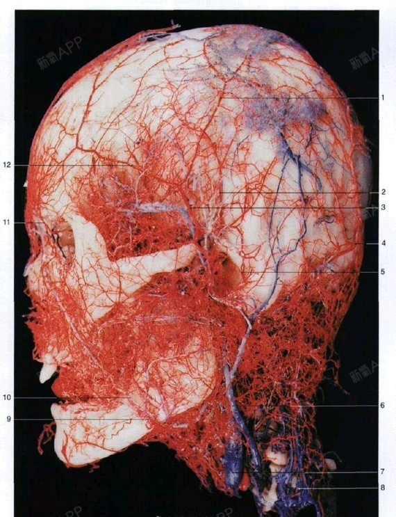 面部分布着大量血管,如果玻尿酸严重压迫或进入眶上