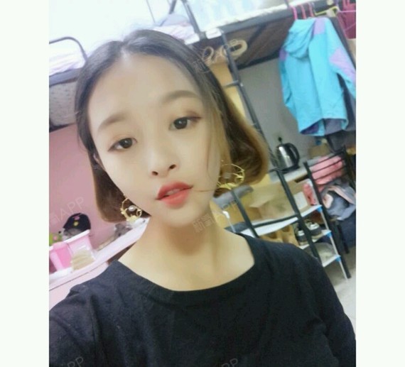 【美莱整形】激光祛除青春痘的原理是什么?激