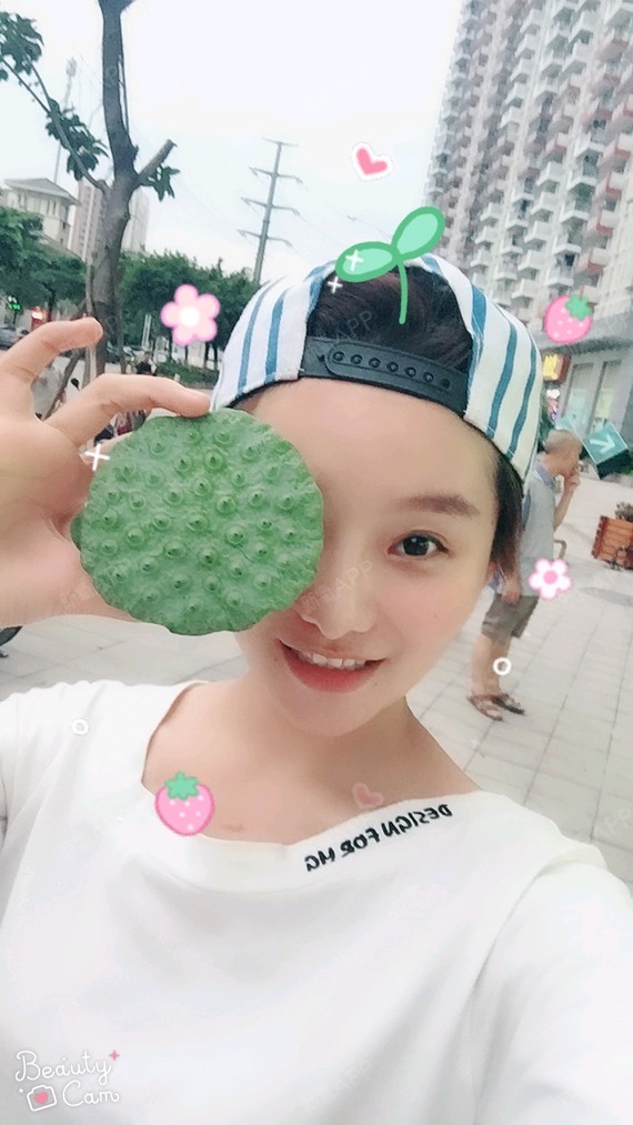 杰杰小妹膨体隆鼻第42天美丽日记-新氧美容整