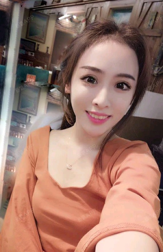 肤白貌美大长腿下一句是自体脂肪全脸填充第1