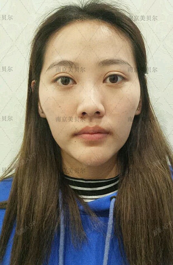 【南京美贝尔--甜美心形脸,减龄又可爱