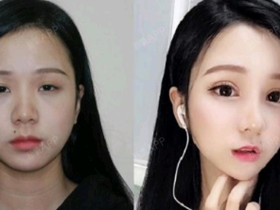 播音主持专业的学生狗一只,高度近视眼,一直都