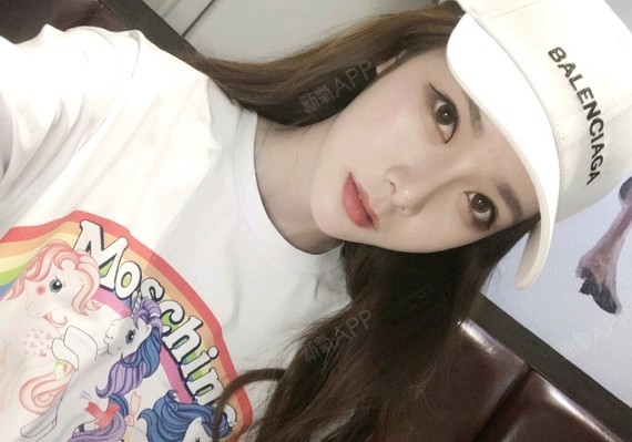 氧痒痒自体脂肪丰面颊第305天美丽日记-新氧美