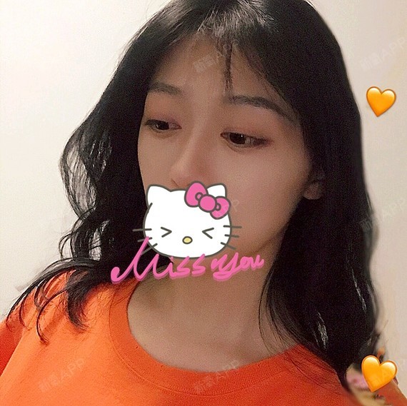 美女氧气22处女膜修复第33天美丽日记干做美女在图片