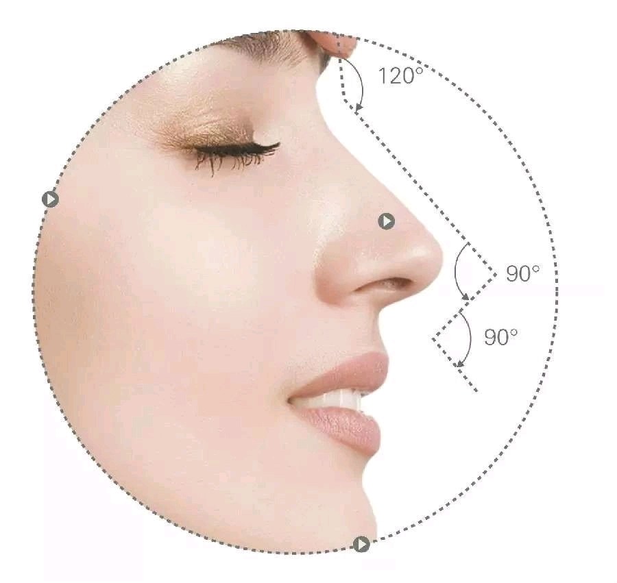 鼻综合手术后会出现鼻孔不对称鼻综合_圈子-新