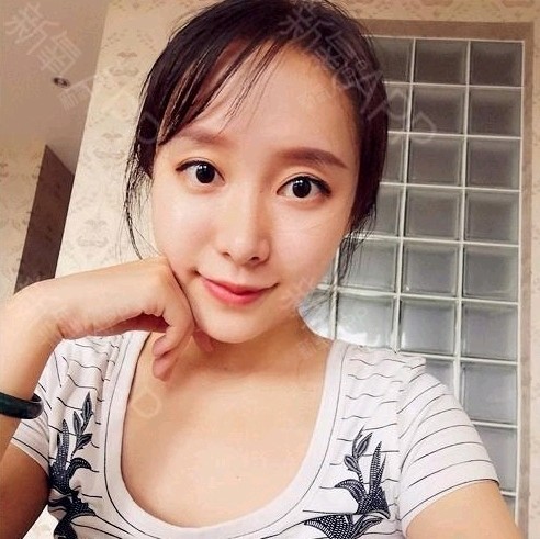 TBM面雕的200天从女生到女神的精美蜕变年龄