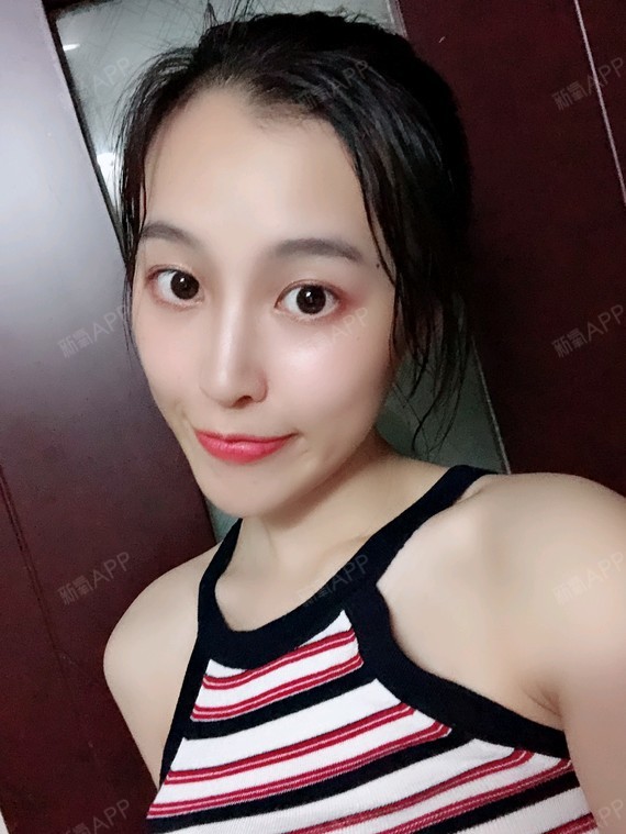 氧气宝宝18肋软骨隆鼻第12天美丽日记-新氧美