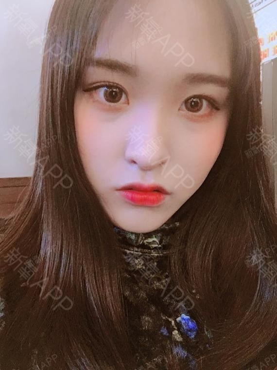 【南通美贝尔--杨国化】美贝尔还你一双灵动大眼睛!