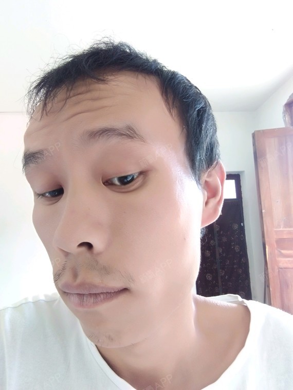 获奖通知--头晕少女元气脸,南昌红苹果免费耳鸣招募打造女生图片