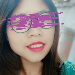 自体脂肪填充可以矫正脸歪吗?谢谢医生