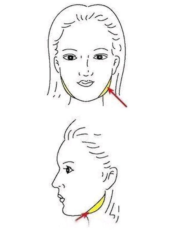 面部吸脂没效果?v脸秘诀全靠下颌缘