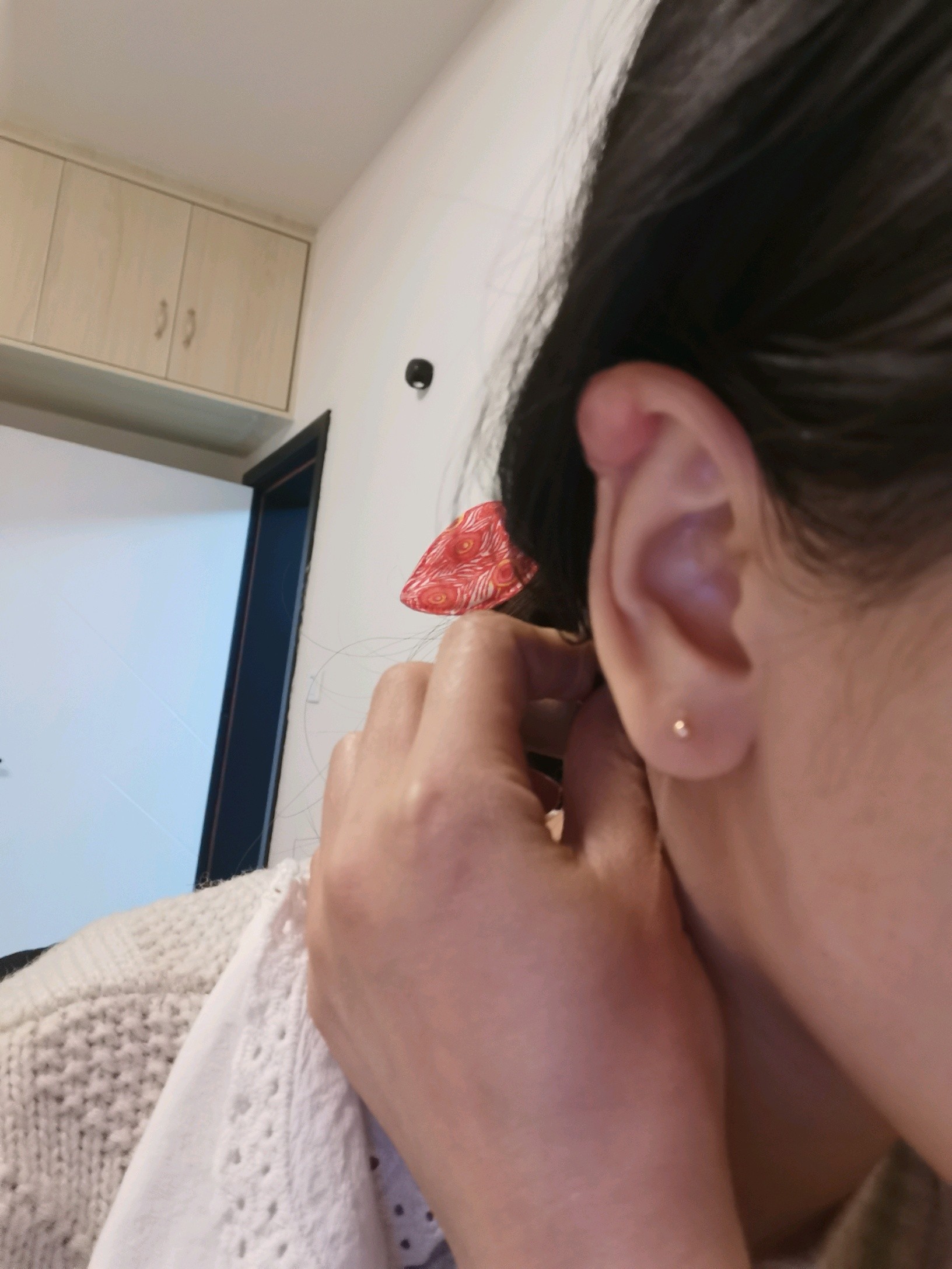 耳朵打耳洞长的疤痕疙瘩怎么治疗?