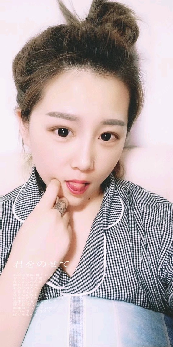 阿拉莜肉毒素瘦脸第15天美丽日记-新氧美容整