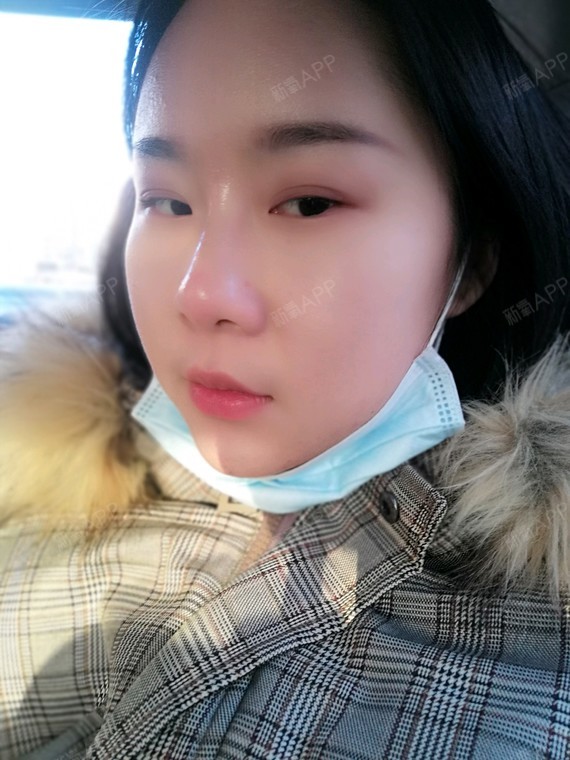 今天第一天   效果明显,不怎么痛