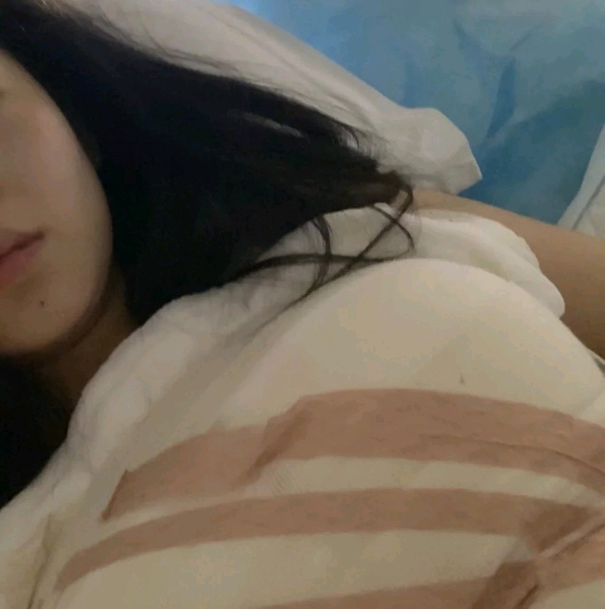假体隆胸第1天