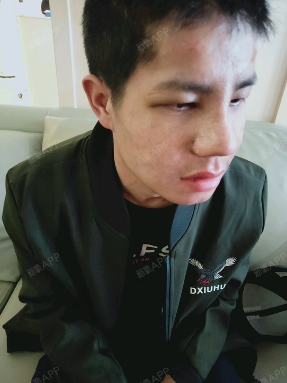 术后当自强