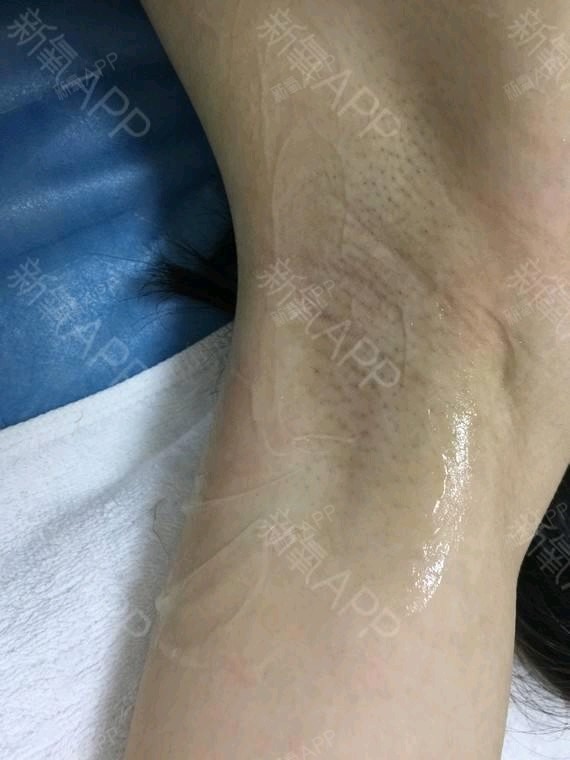 可不啊啊啊脱丽日第0天美女生记-新氧v丽日腋毛前列腺男图片