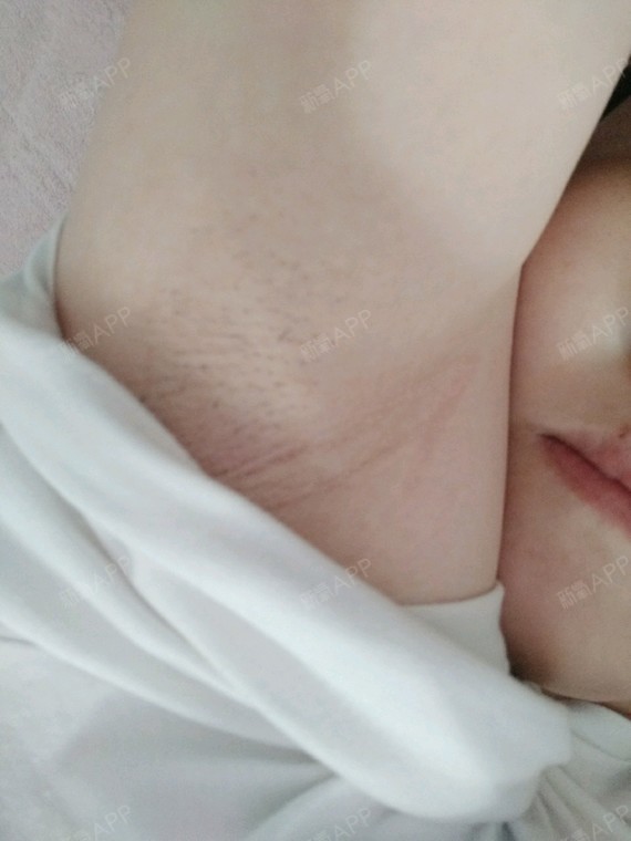 毛毛长的慢.也不多.挺好的.比自己用脱毛膏好.毕竟人家是专业的!