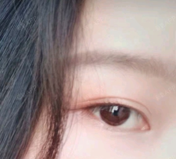 我是眯缝眼,聚光,这是自己安慰自己的话,现在变成双眼皮,眼睛