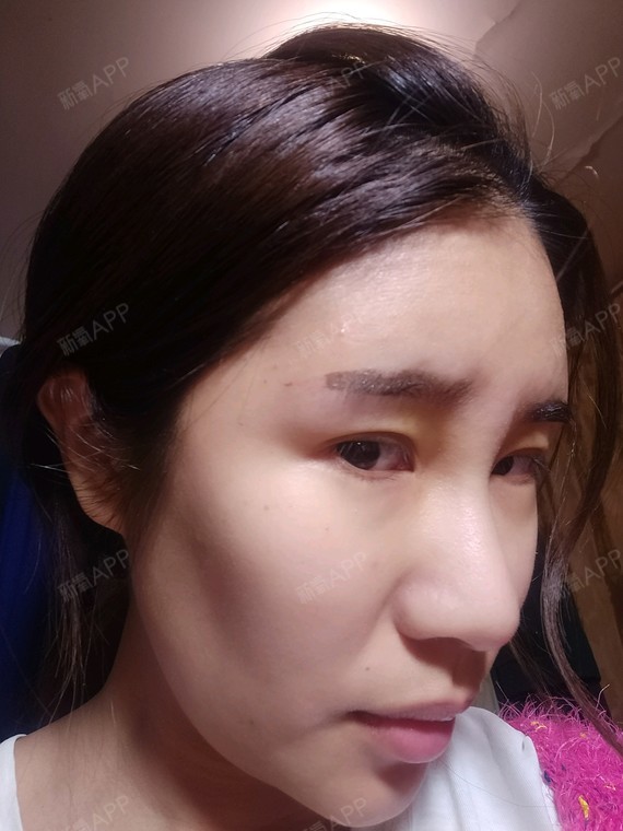 也太太太浅了吧,就算到反色期感觉也不会返多深出来的说…看补色吧