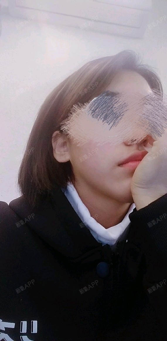 比基尼线脱毛好不好_效果图_哈尼爱你吖比基尼线脱毛