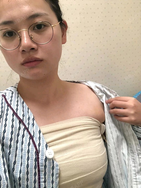 我是在结婚后才有丰胸的意识,想起时青春期上学刚发育