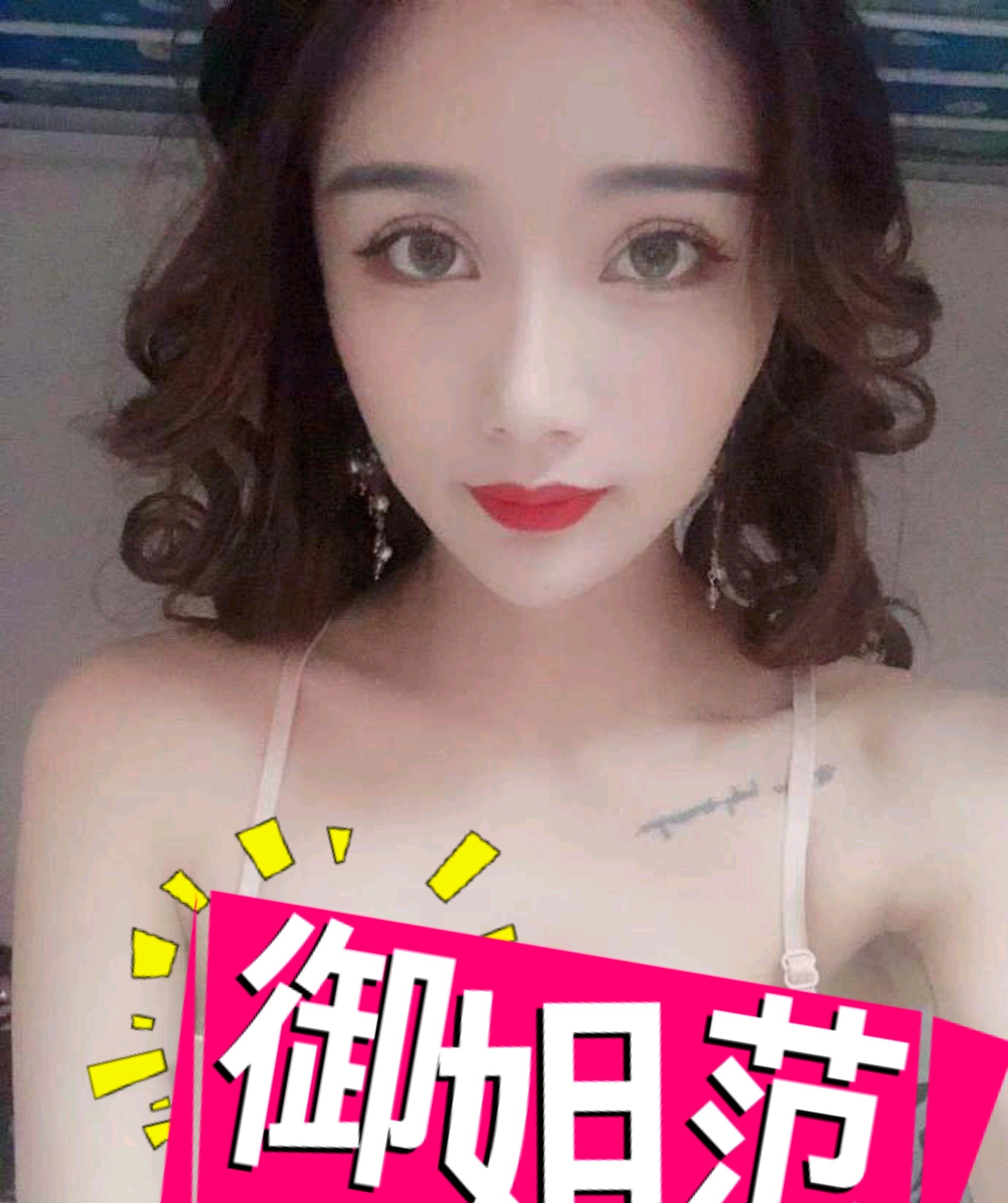 郑州缔莱美医疗美容医院假体隆胸怎么样_恢复过程__6r