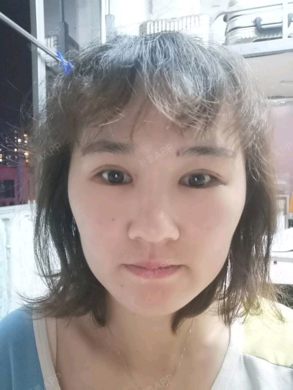 开外眼角