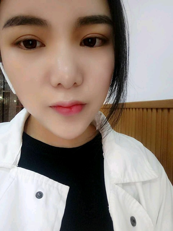 鼻翼缩小手术安全吗?鼻翼肥大让鼻子看起来不够挺而且还影响整体面部的五官，_圈子-新氧美容整形