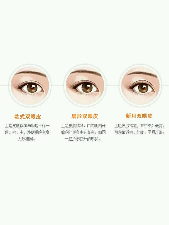 双眼皮类型有三种