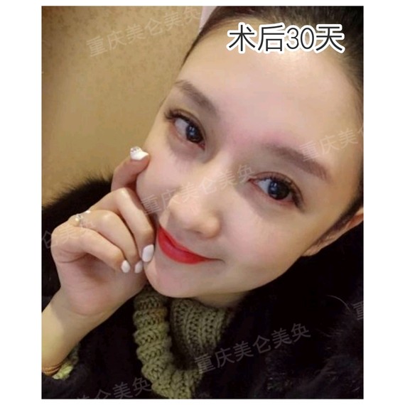 上眼窝凹陷好老气怎么办?这样做让你年轻十岁