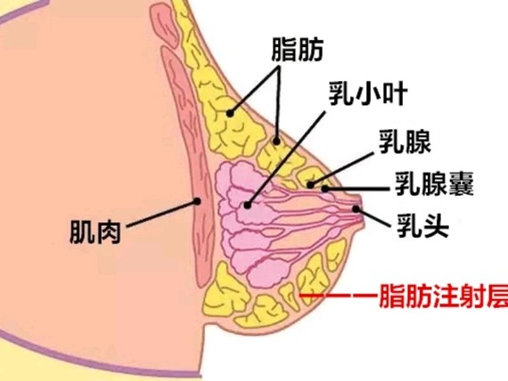 乳腺增生到底能做自体脂肪丰胸吗?