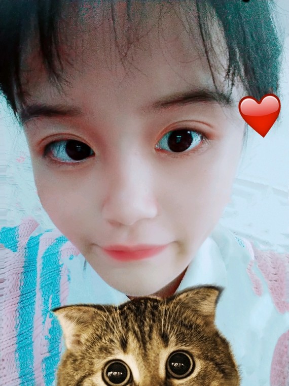 周瑞倩肉毒素瘦脸第83天美丽日记-新氧美容整