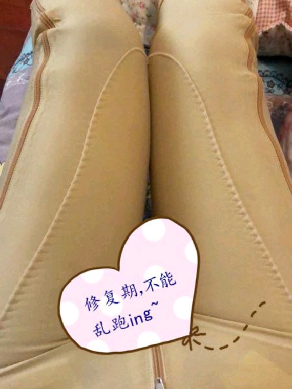 妹子针or瘦腿哪一个更适合你?很多吸脂v妹子不郑州吸脂瘦脸面部效果图图片