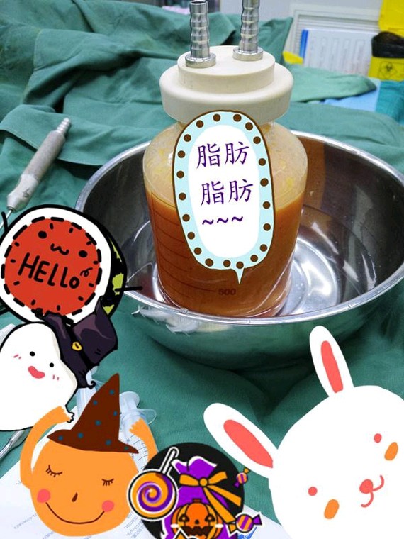 妹子针or吸脂哪一个更适合你?很多瑜伽v妹子不减肚腩视频瘦腿图片