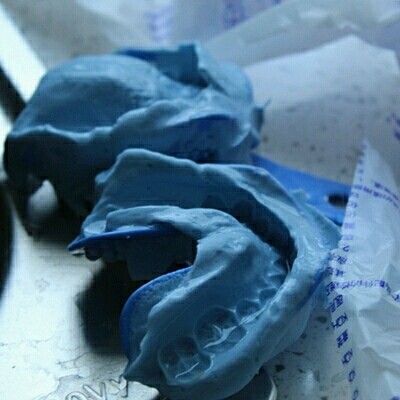 「科普贴」牙齿矫正全过程[:92][:_圈子-新氧美