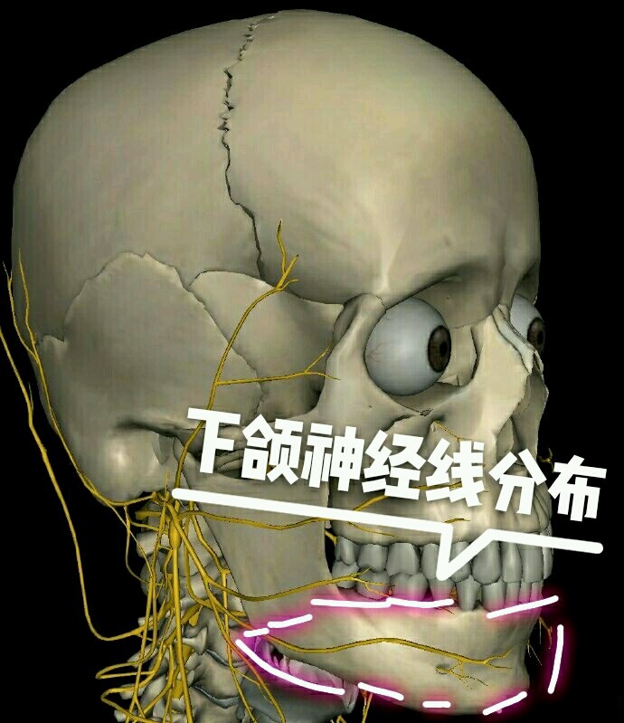 【what削骨削到大出血靠谱下颌角手术保命指南】