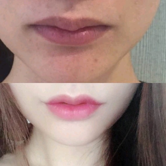 更是带火了这两年来的唇部整形~~~   为什么说她的唇好看呢?