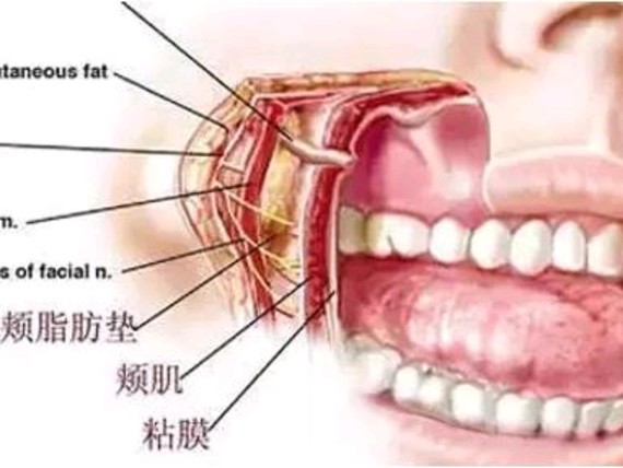 脸部看起来总算微胖圆嘟嘟,显得脸大  颊脂垫取出方式  在口腔黏膜颊