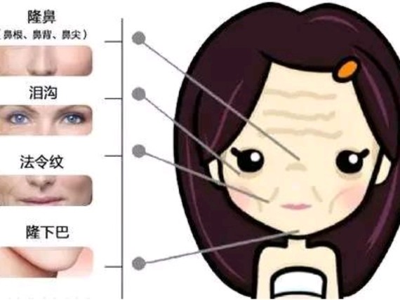 玻尿酸为何让女人们都折服?玻尿酸是一种透明质酸原液，含有玻尿酸保_圈子-新氧美容整形