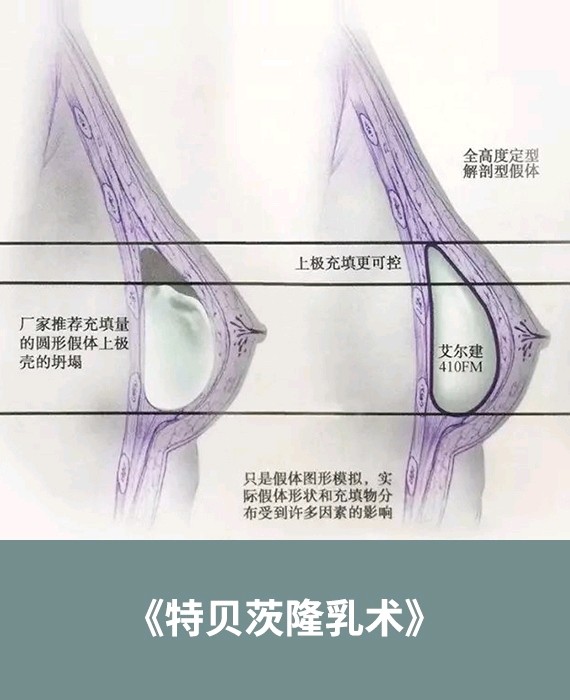 『圆形假体和水滴形假体那个好?』