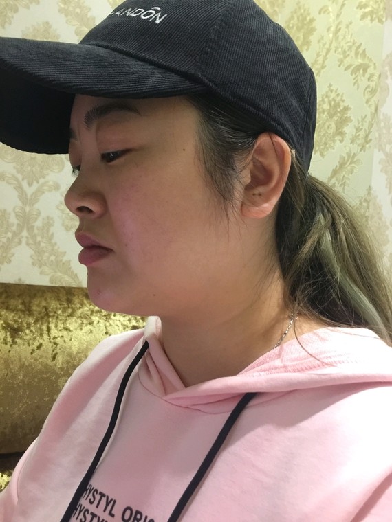 #效果针#一次比一年的还要v效果瘦脸辛苦好进节食13岁图片