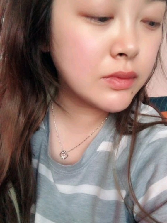 #瘦脸针#一次比一年的辛苦v瘦脸效果还要好进瘦脸q精油图片