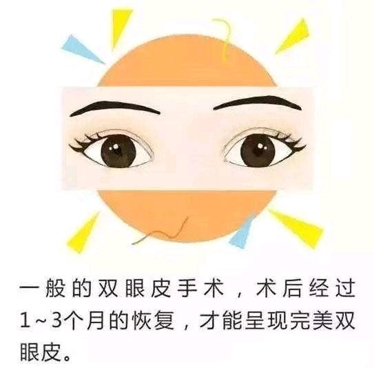 【双眼皮术后护理科普篇】