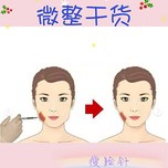 微整干货之a型肉毒(瘦脸针)注意所有的注射类医美一定一定
