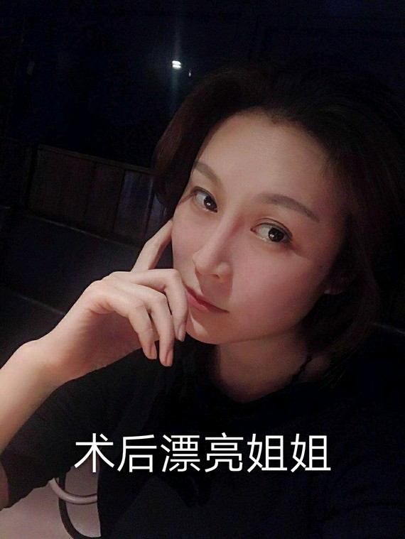 填充大坑避开四性感,get自然童颜脸豆瓣脂肪移安妮海自体瑟脂肪薇图片